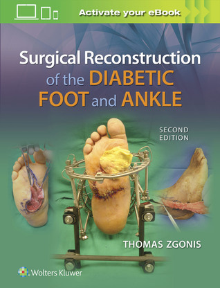 [cf919] ^F.u.l.l.@ @D.o.w.n.l.o.a.d^ Surgical Reconstruction of the Diabetic Foot and Ankle - Thomas Zgonis #ePub*