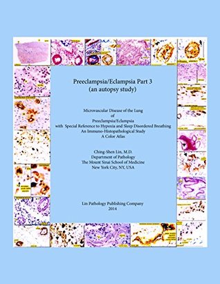 [07d4e] ~Download* Preeclampsia/Eclampsia Part 3 (an autopsy study): Microvascular Disease of the Lung in Preeclampsia/ Eclampsia with Special Reference to Hypoxia and Sleeping  Breathing (Preclampsia/Eclampsia Updated) - Ching-Shen Lin ^PDF%