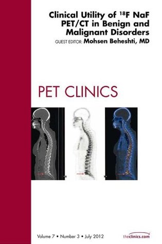 [8b7a6] ^Read@ Clinical Utility of 18NaF PET/CT in Benign and Malignant Disorders, An Issue of PET Clinics - E-Book (The Clinics: Radiology) - Mohsen Beheshti #P.D.F*