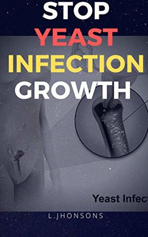 [9d394] @R.e.a.d# Stop Yeast Infection Growth: a Quick And Simple Ways - L. johnson's %PDF@